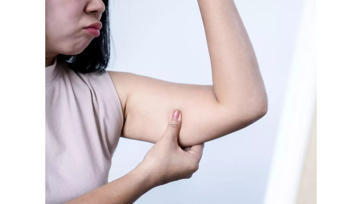 Understanding Arm Fat